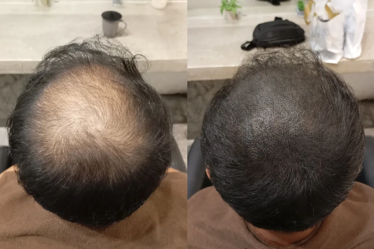 Pelanggan Anggun Pakar Rambut, sebelum dan selepas