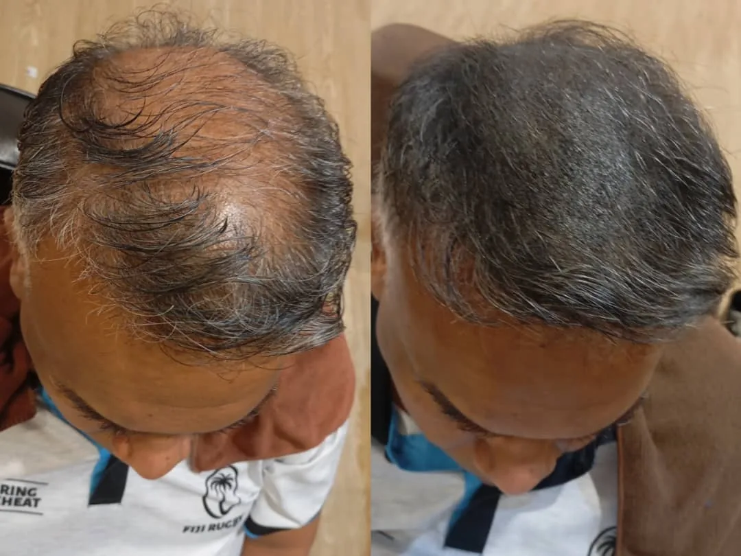 Pelanggan Anggun Pakar Rambut, sebelum dan selepas